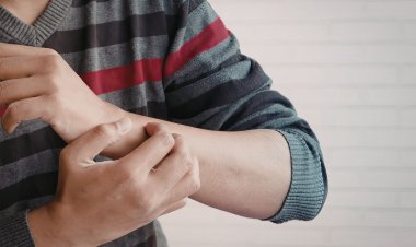 Dermatologista e psicóloga explicam que problemas físicos ou emocionais podem ser gatilhos para esse sintoma tão comum
