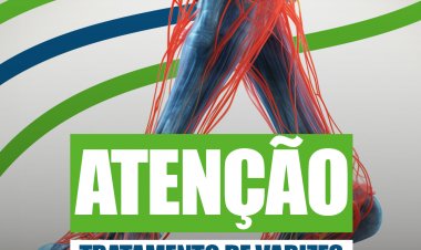 Saúde que transforma vidas: sucesso do tratamento de varizes garante nova etapa em Casa Nova